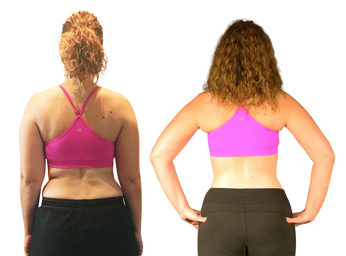 Barbara's before and after back